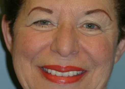 Case kathy after query